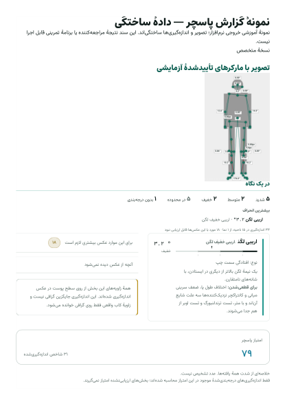 Practitioner version — first page of a synthetic sample with confirmed landmarks and lines